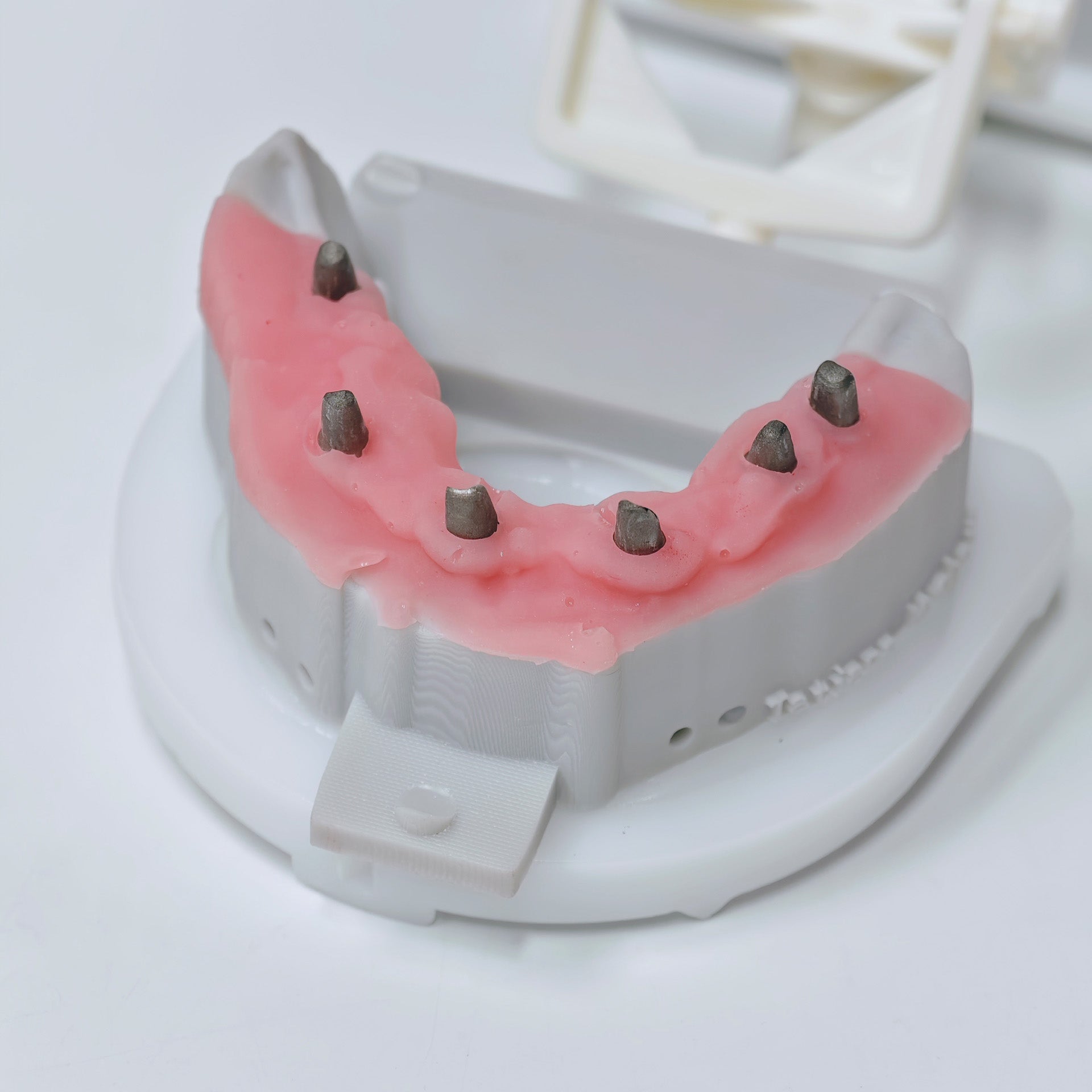 Custom Abutment And PMMA Bridge With Cement Retained And Implant Seating Guide