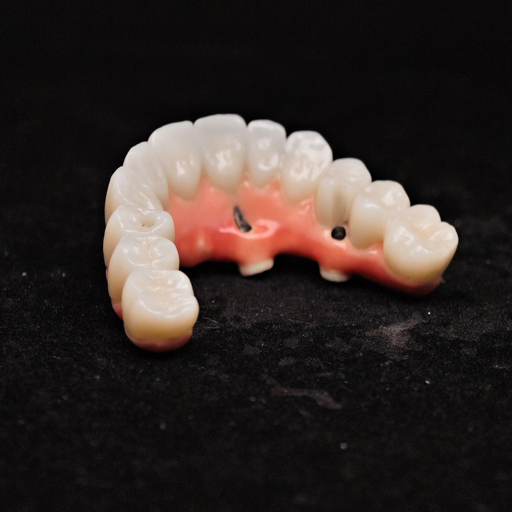 Enhanced Zirconia Crown Malo Bridge