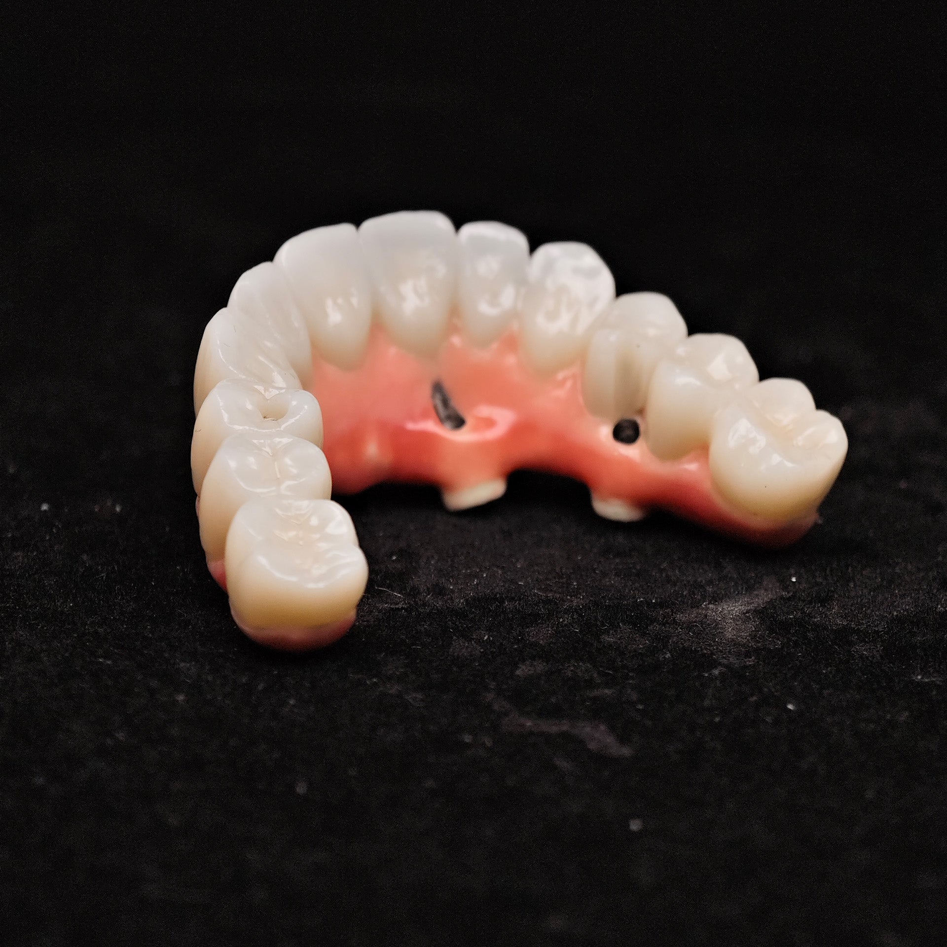 Enhanced Zirconia Crown Malo Bridge