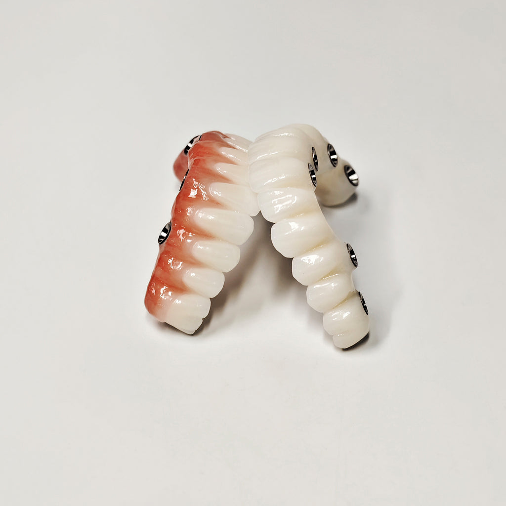 Full-Arch Zirconia Bridge With Ti-Base Abutment