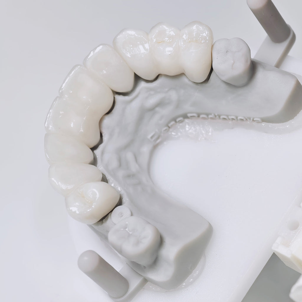 High - Strength Zirconia Bridge Aesthetic