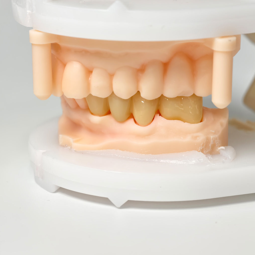 High - Strength Zirconia Bridge
