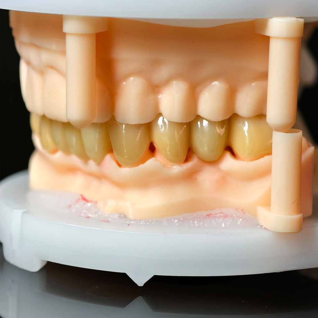 High - Strength Zirconia Bridge