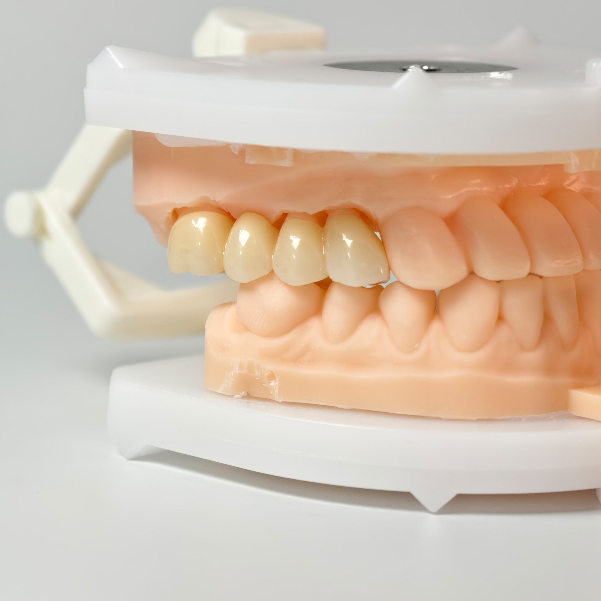High - Strength Zirconia Bridge