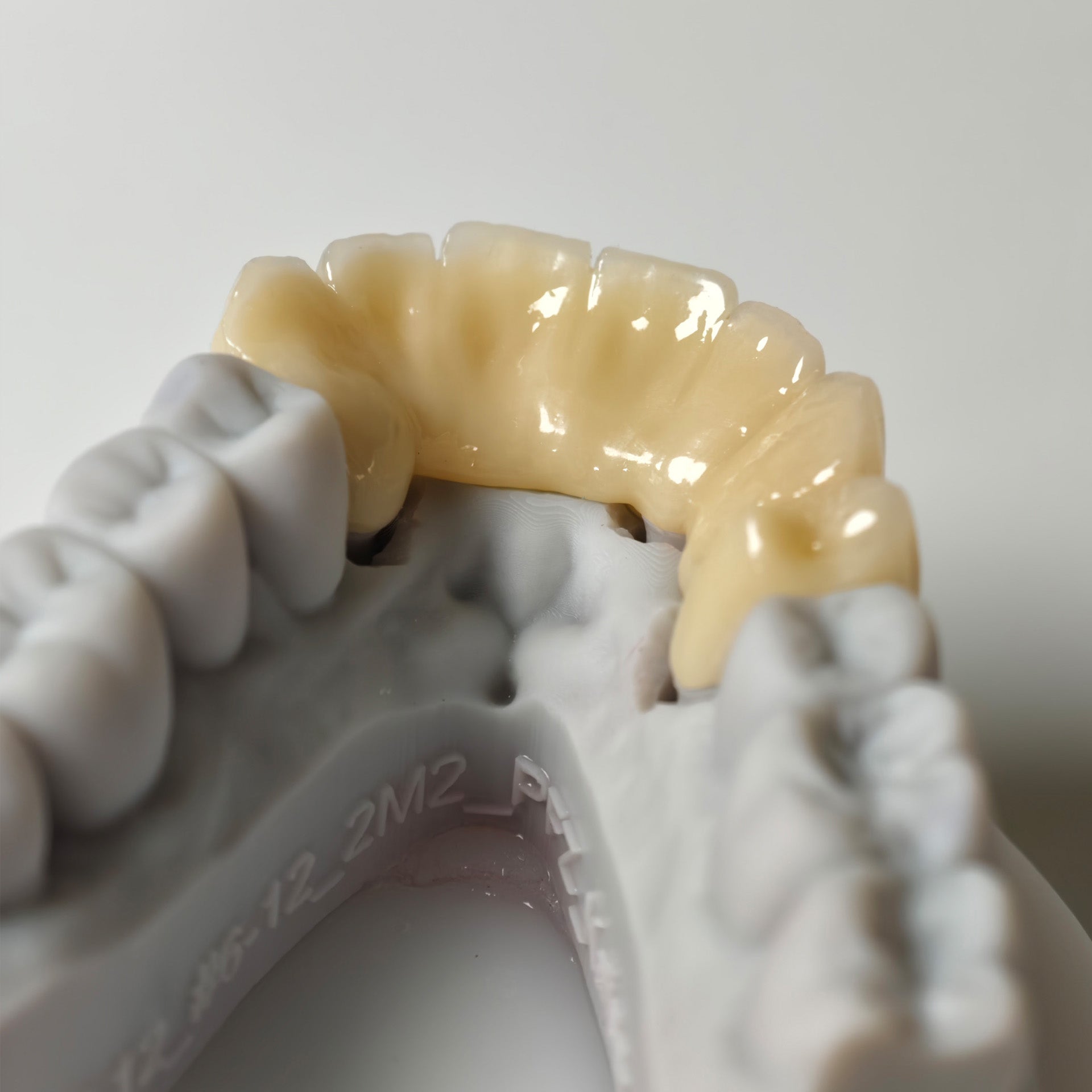 High - Strength Zirconia Bridge