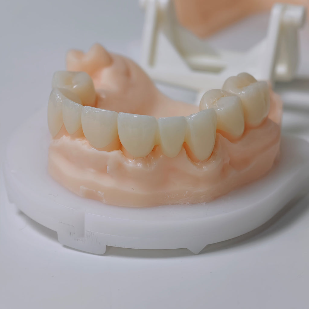 High - Strength Zirconia Bridge And Crown