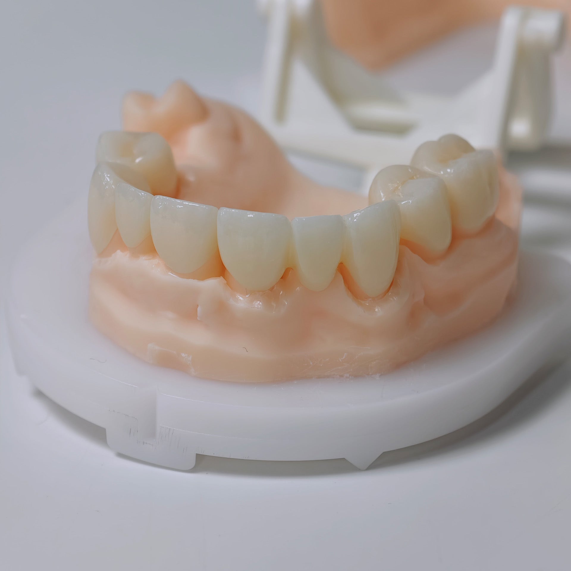 High - Strength Zirconia Bridge And Crown