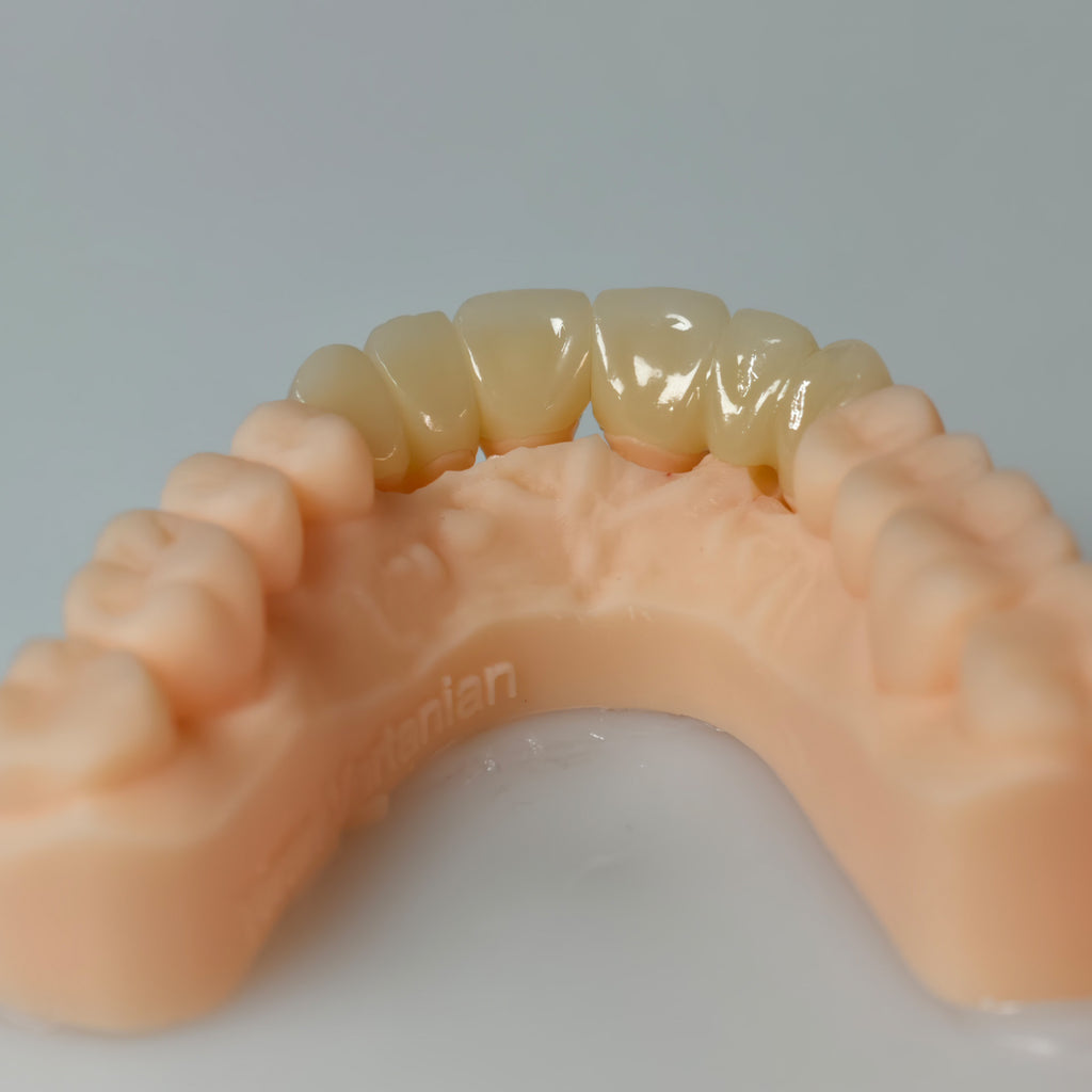 High - Strength Zirconia Bridge And Crown
