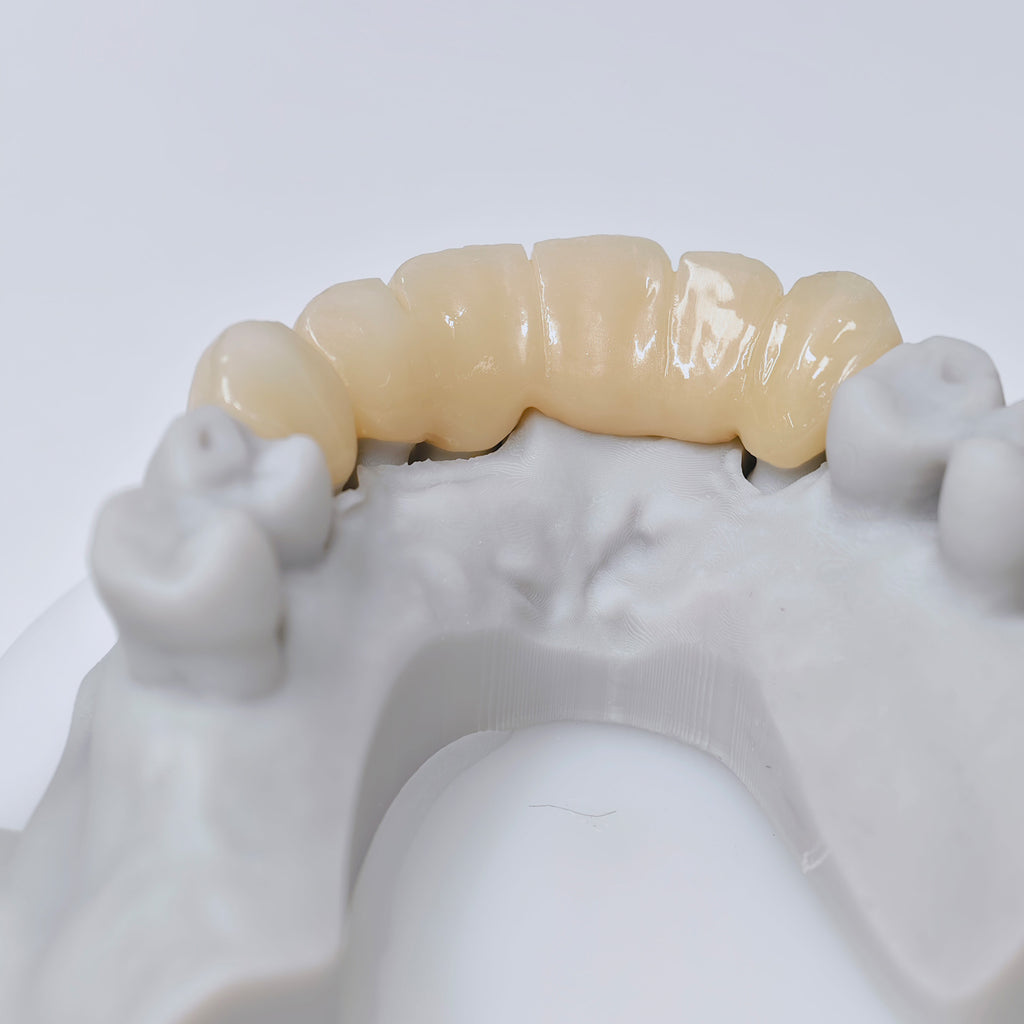 High - Strength Zirconia Crown And Bridge