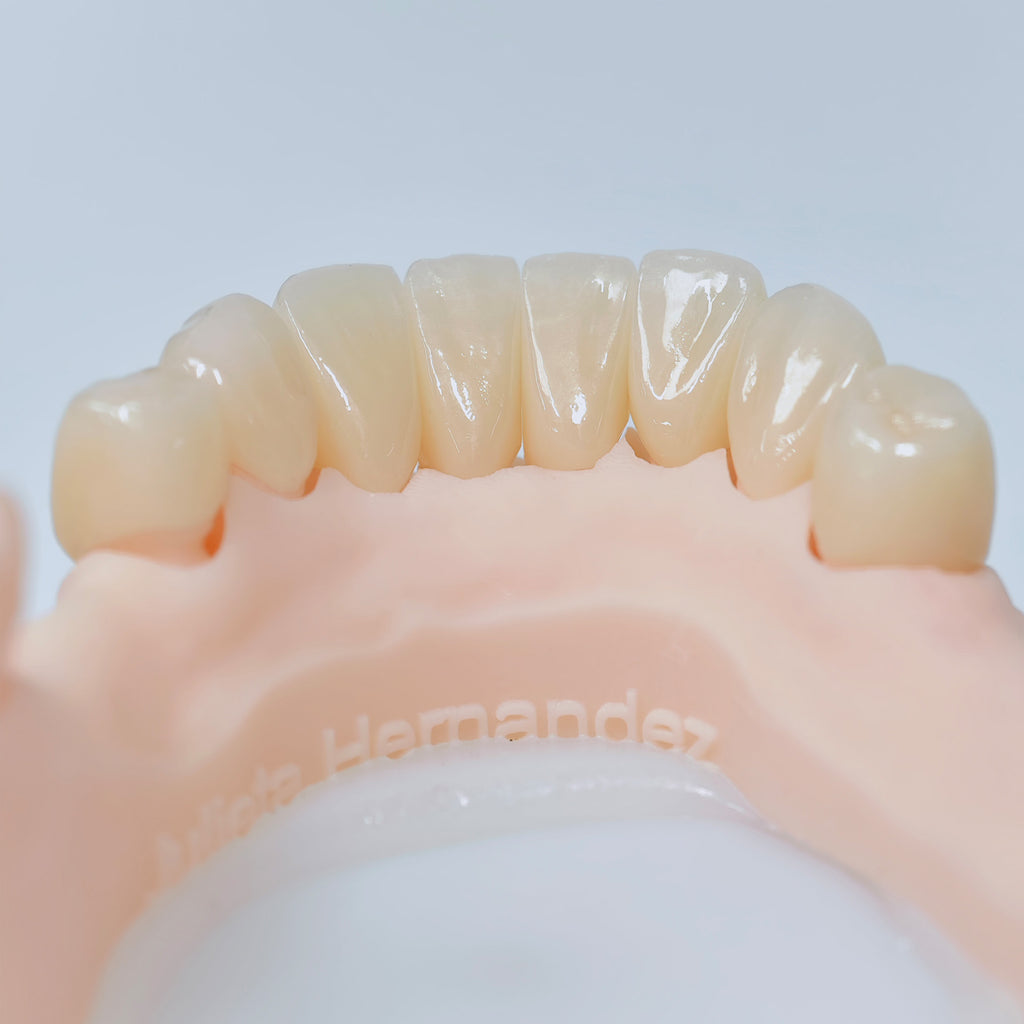 High - Strength Zirconia Crowns