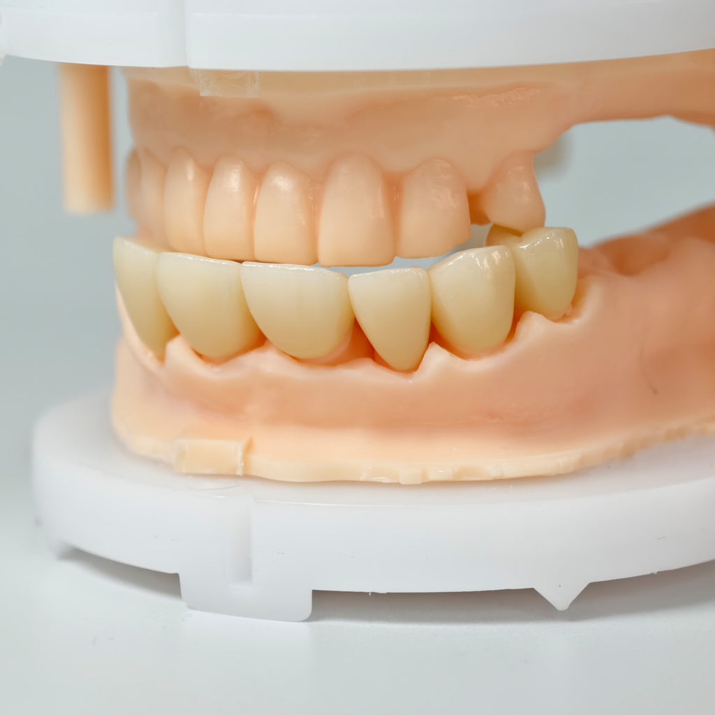 High - Strength Zirconia Crowns