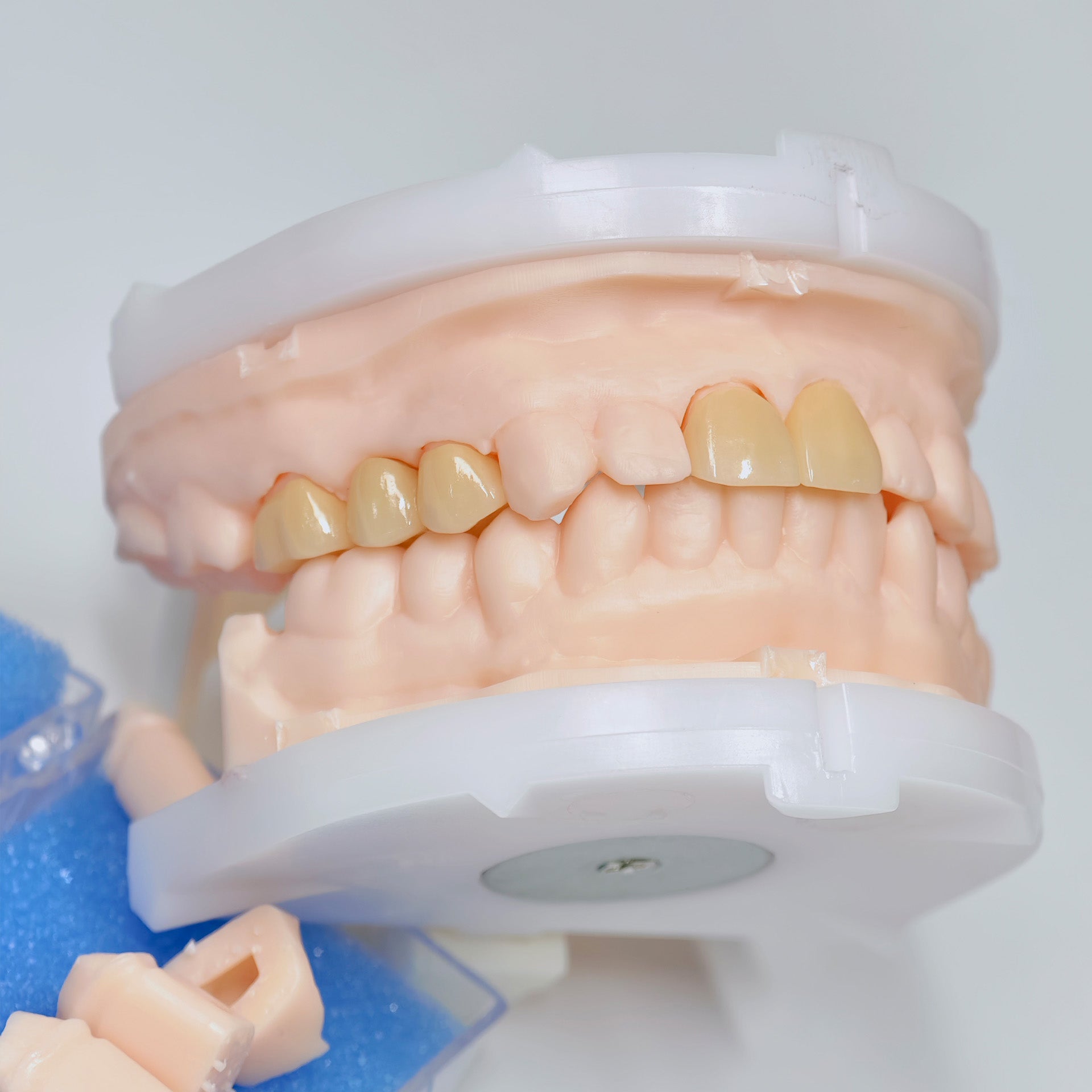 High - Strength Zirconia Crowns