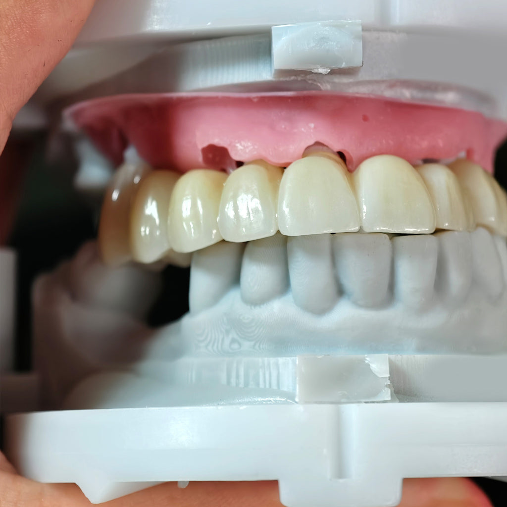 High - Strength Zirconia Crowns And Bridge