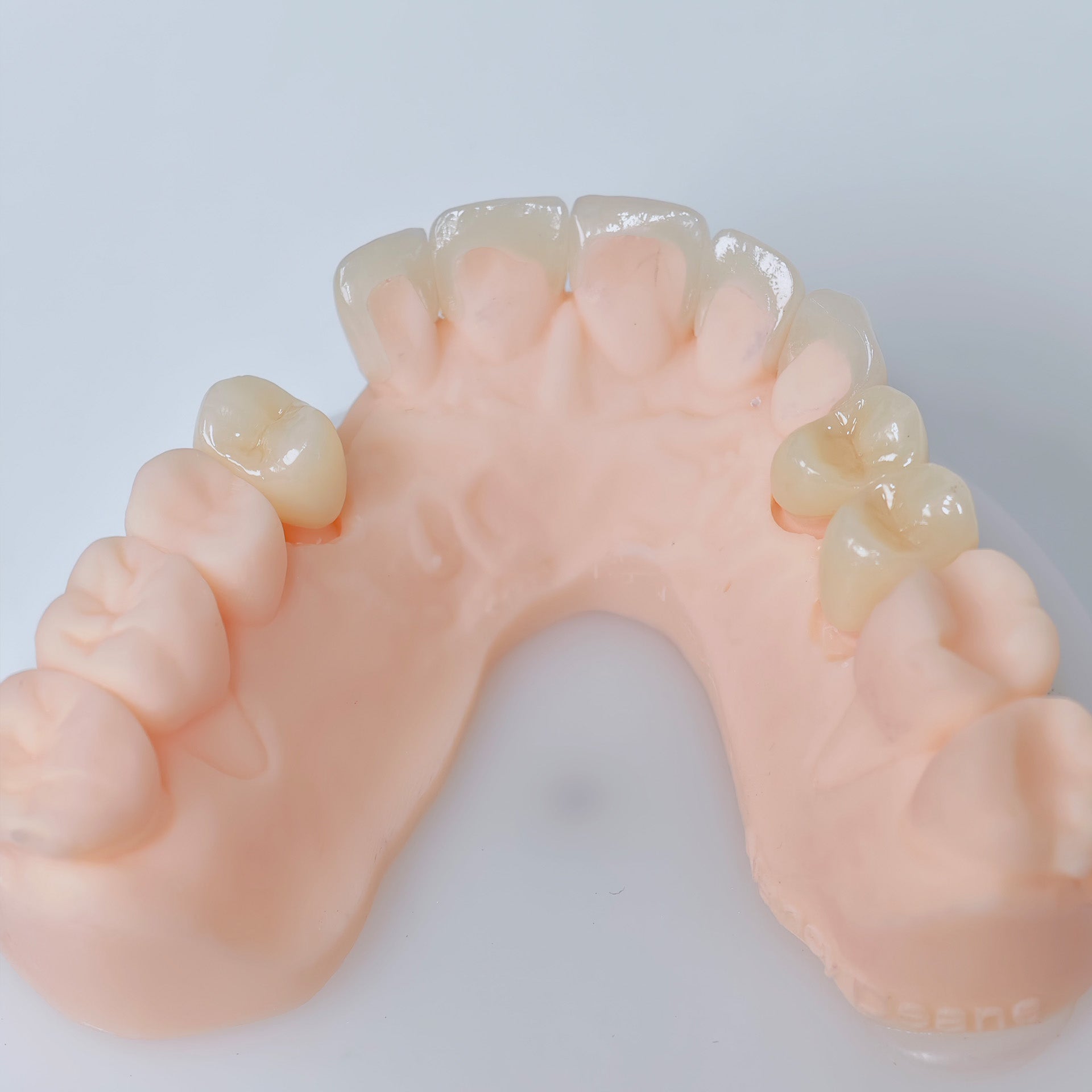 High - Strength Zirconia Crowns And Ceramic Veneers
