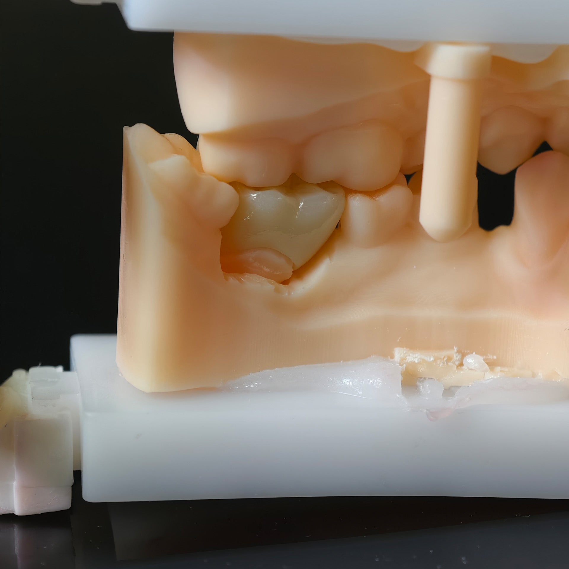 High - Strength Zirconia Dental Crown