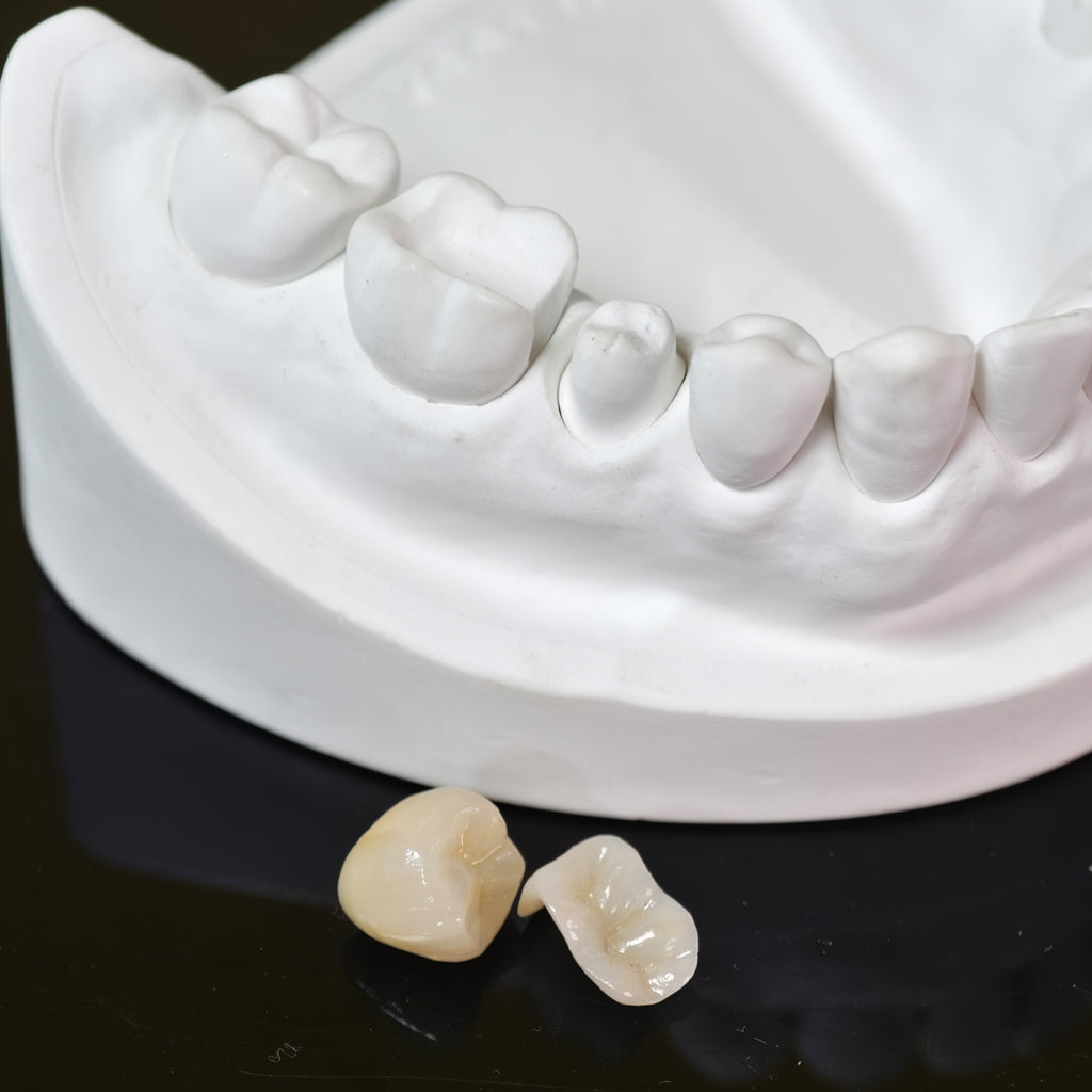High - Strength Zirconia Inlay And Crown