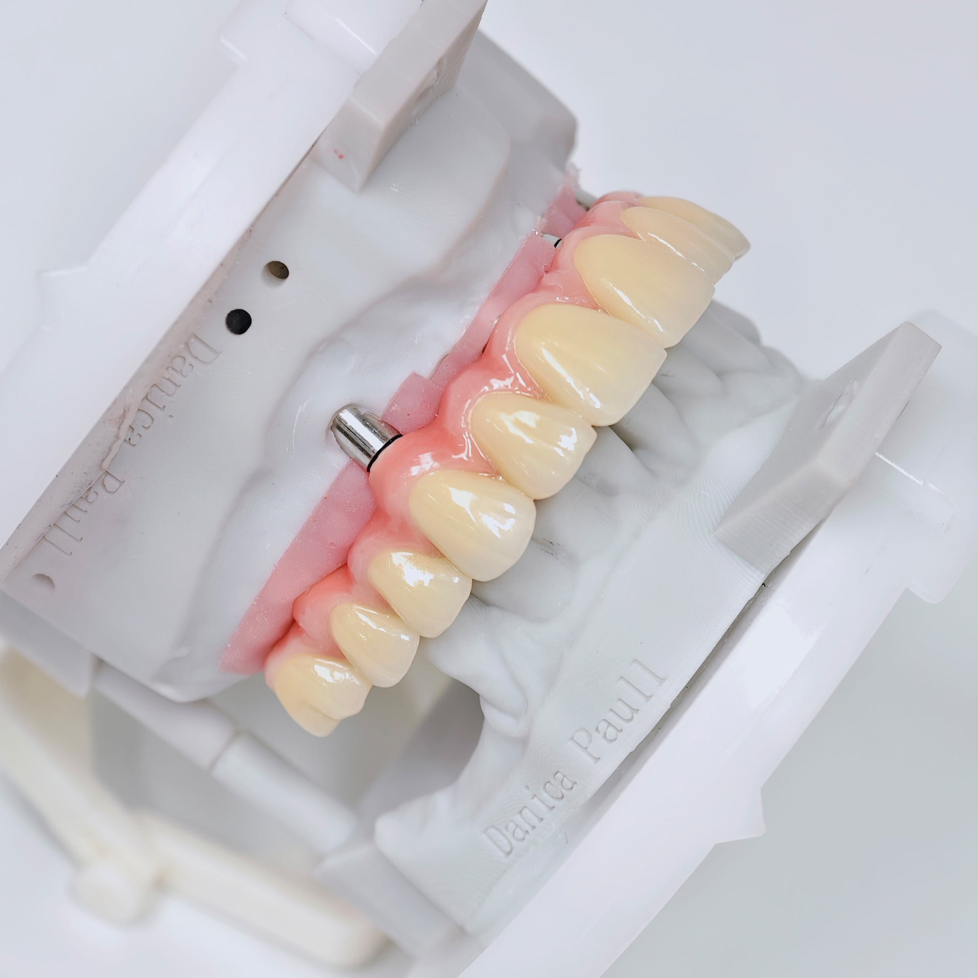 Malo Bridge With Screw-Retained