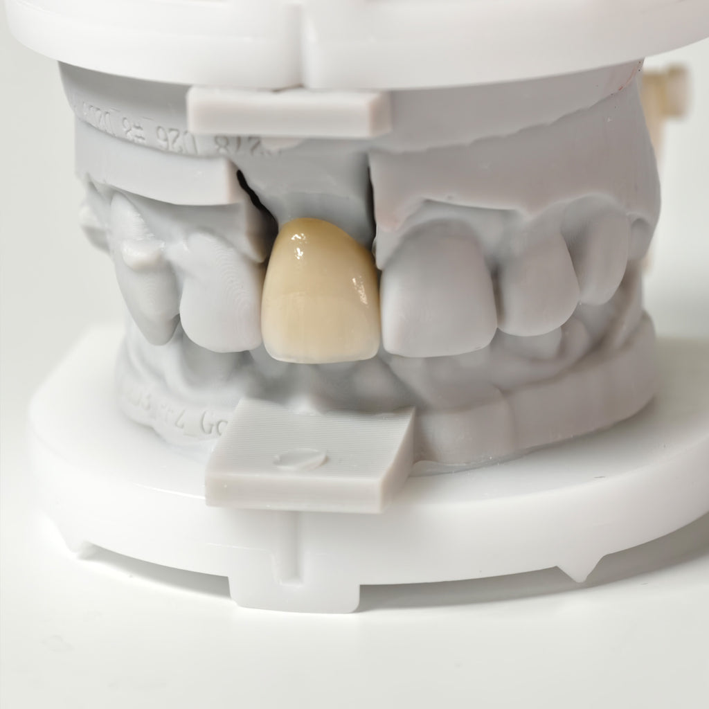 Multilayer Zirconia Crowns Aesthetic Shape Natural Shade Dental Crown