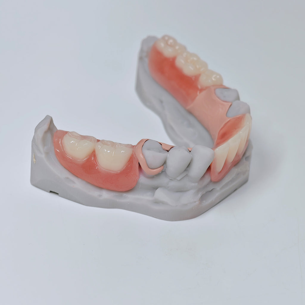 PEEK Framework Denture Metal Framework With Acrylic Denture