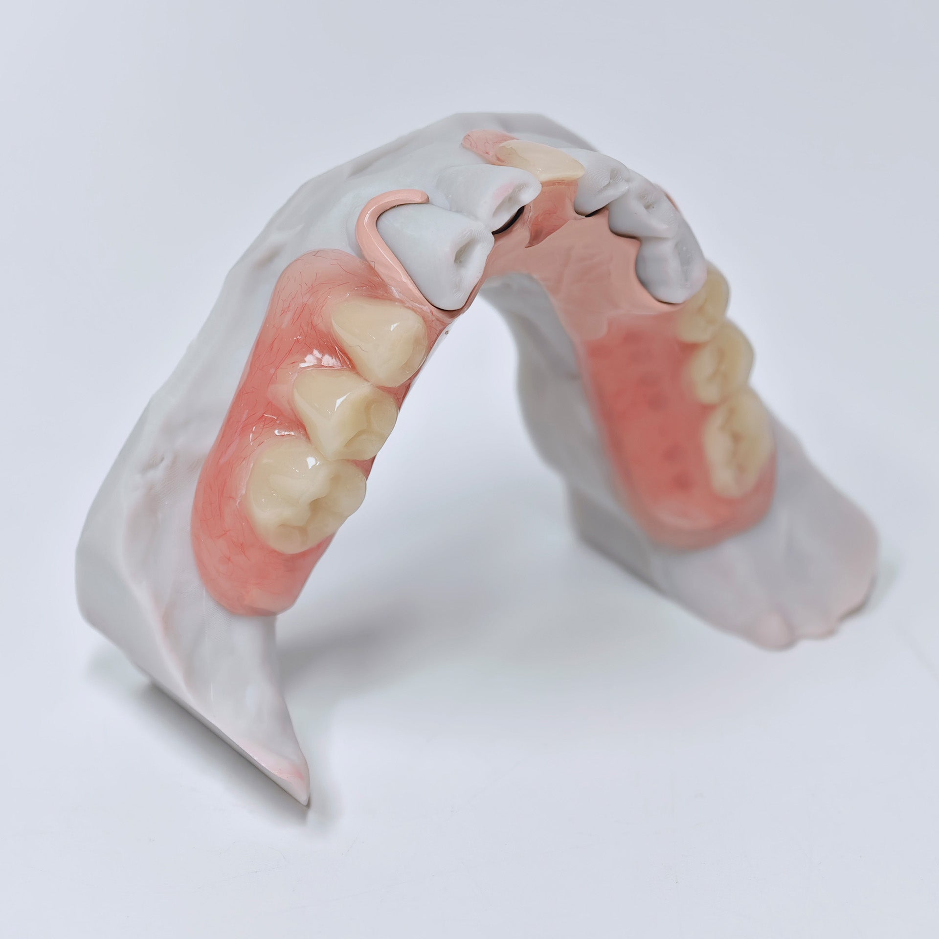 PEEK Framework Denture Metal Framework With Acrylic Denture
