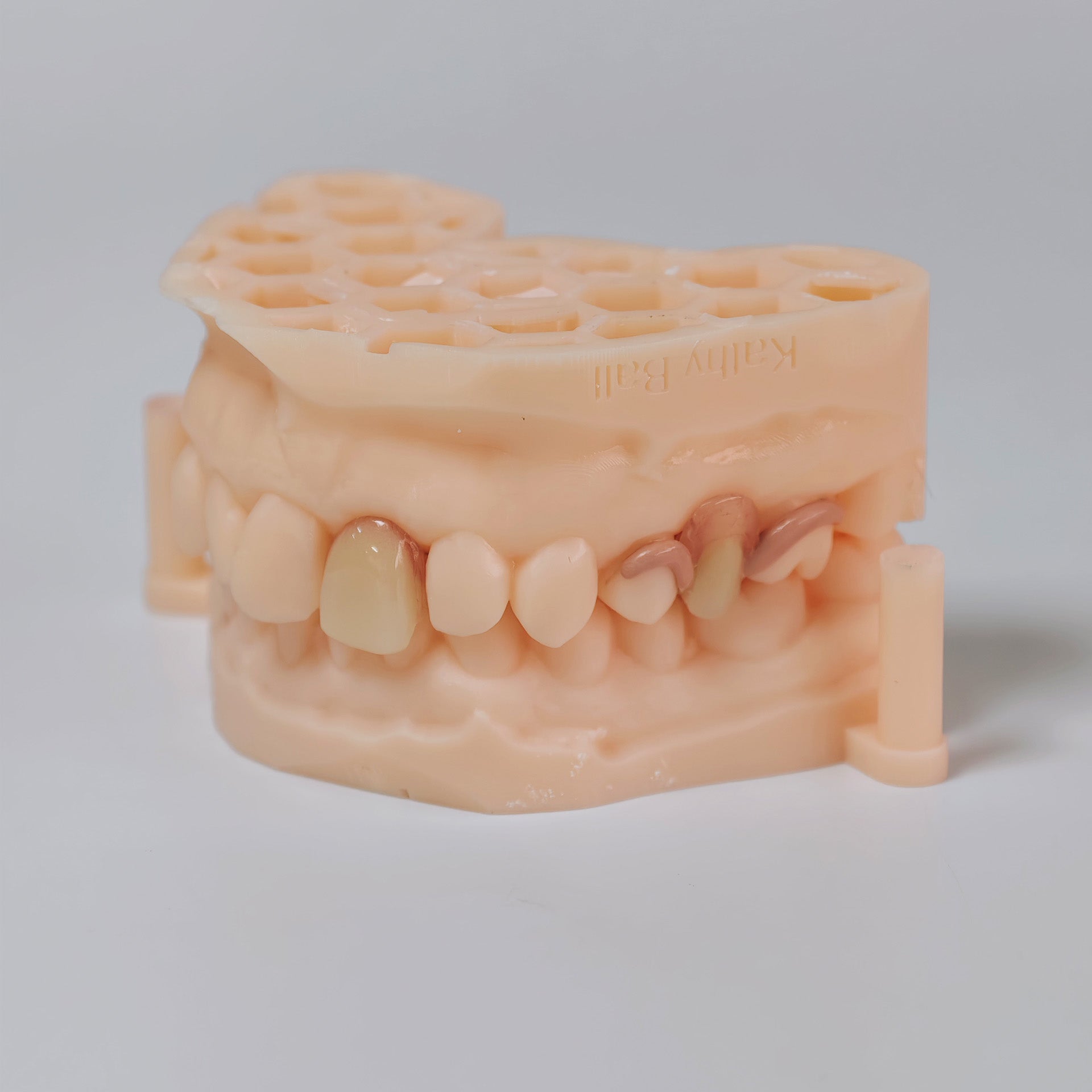 PEEK Framework Denture Metal Framework With Acrylic Denture