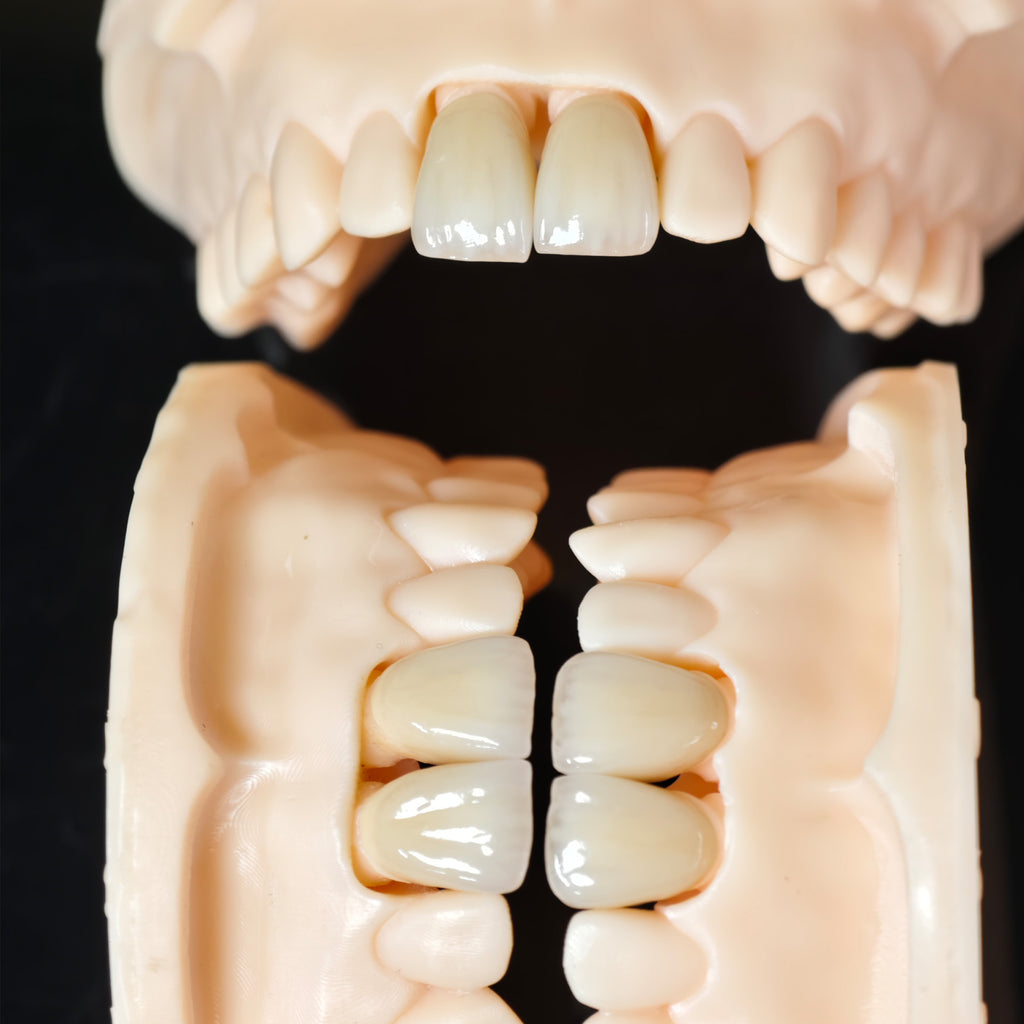 PFZ Crowns Aesthetic Shape Natural Shade Dental Crown
