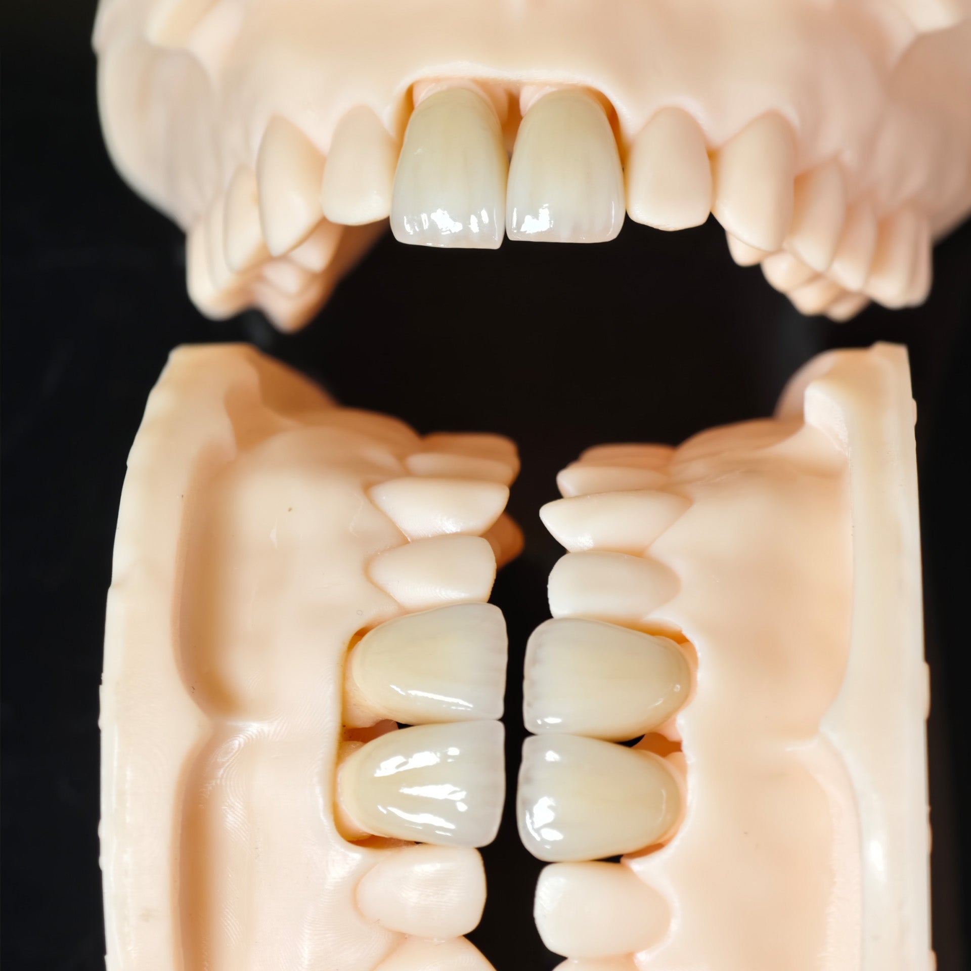 PFZ Crowns Aesthetic Shape Natural Shade Dental Crown