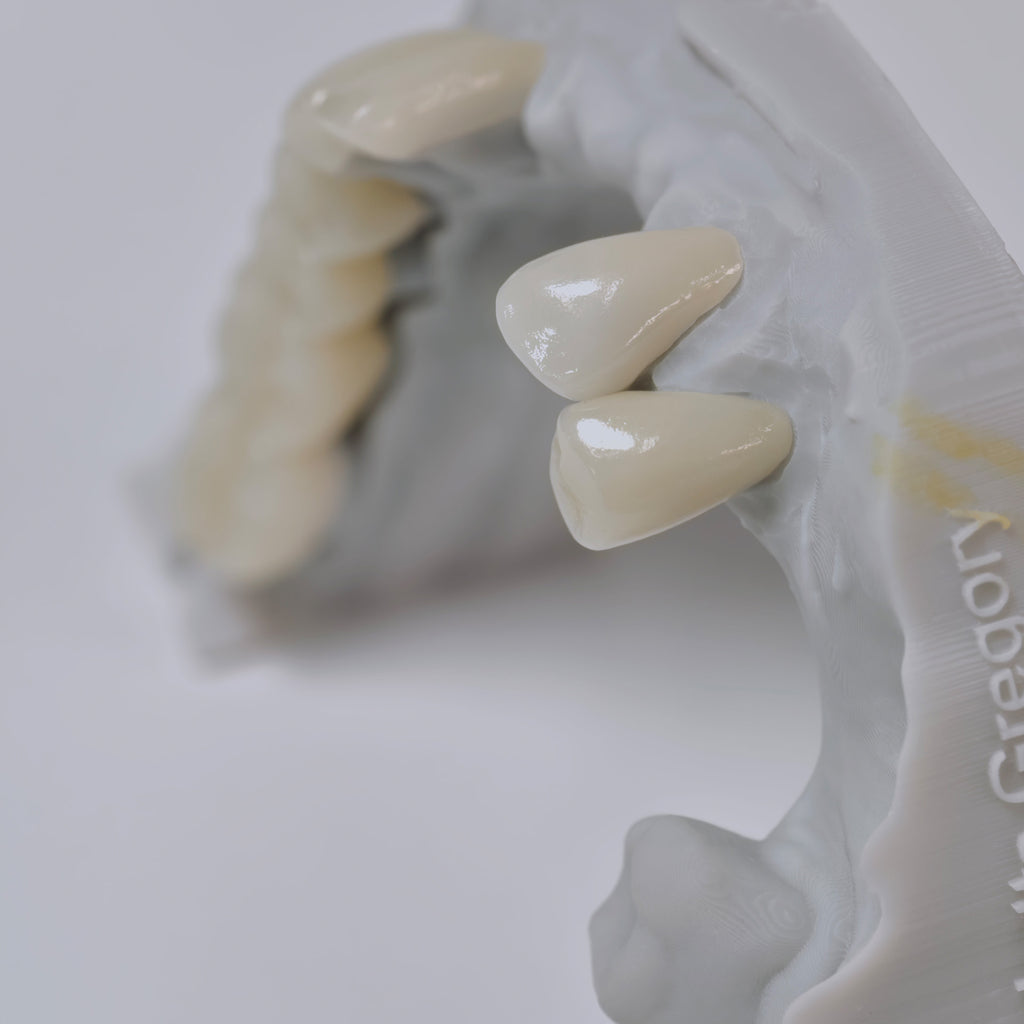 PFZ Porcelain Fused Zirconia Aidite Zirconia