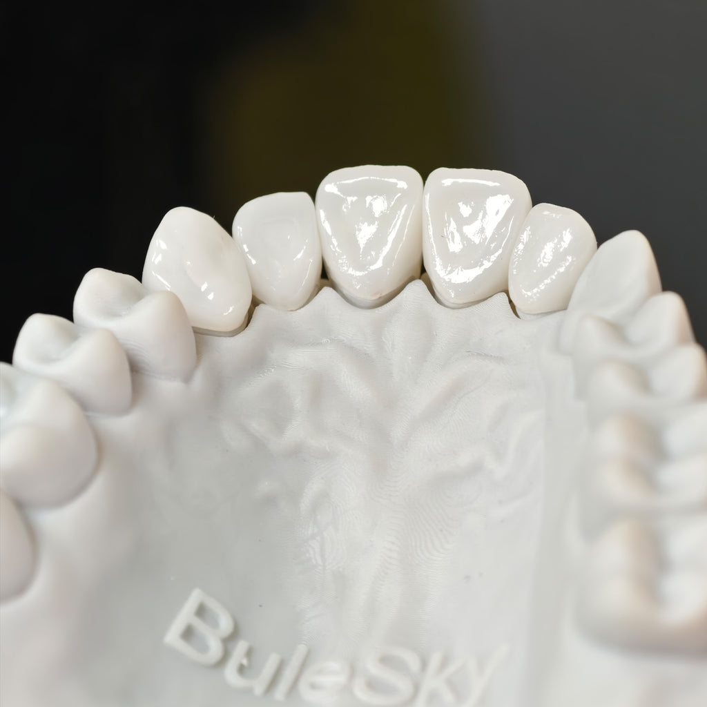 PFZ Porcelain Fused Zirconia Aidite Zirconia