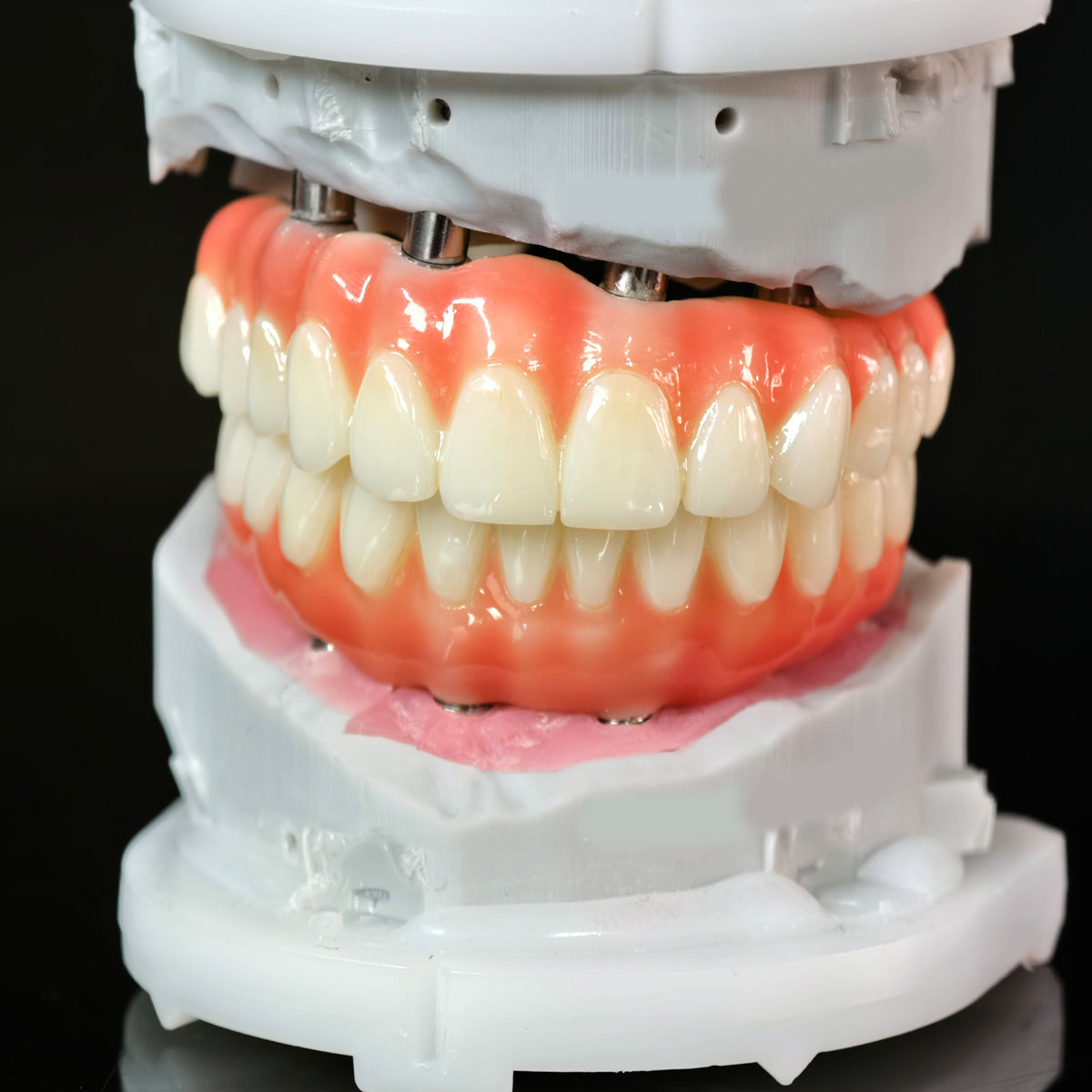 PMMA Bridge With Ti-Base Screw Retained Trying For Full Arch Restoration