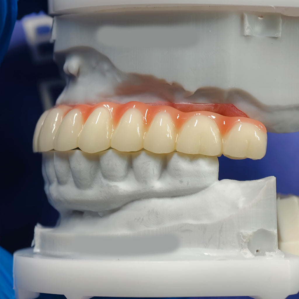 PMMA Bridge With Ti-Base Screw Retained Trying For Full Arch Restoration