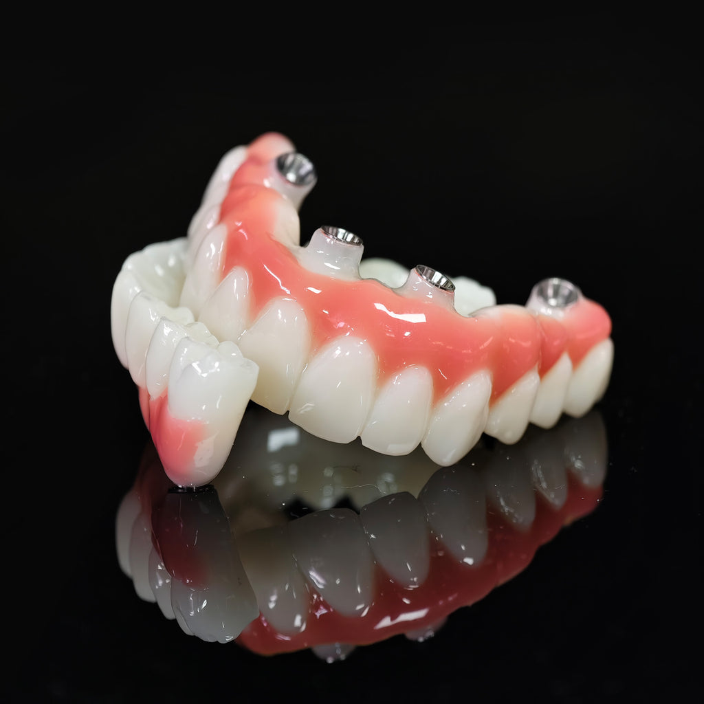 PMMA Bridge With Ti-Base Screw Retained Trying For Full Arch Restoration