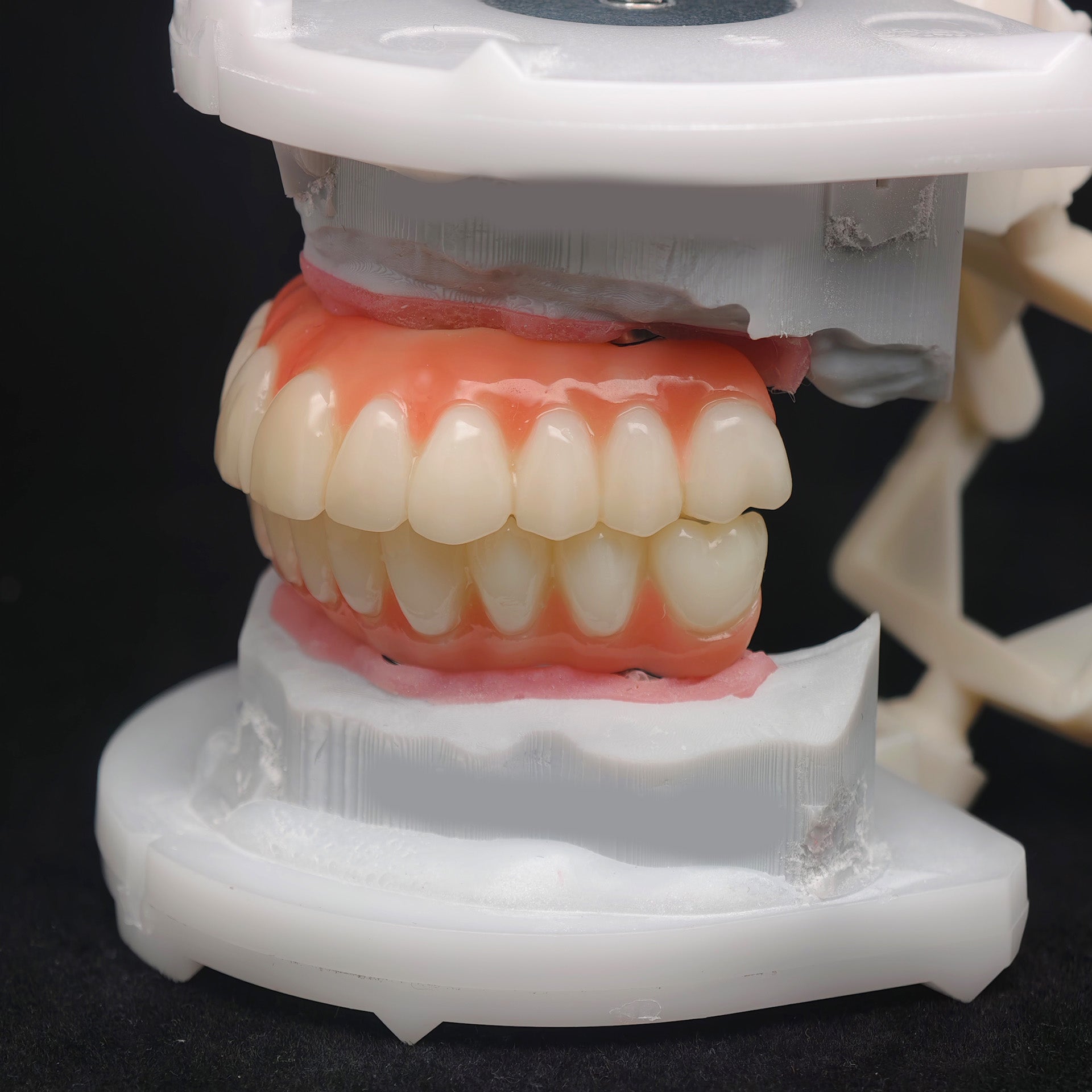 PMMA Bridge With Ti-Base Screw Retained Trying For Full Arch Restoration