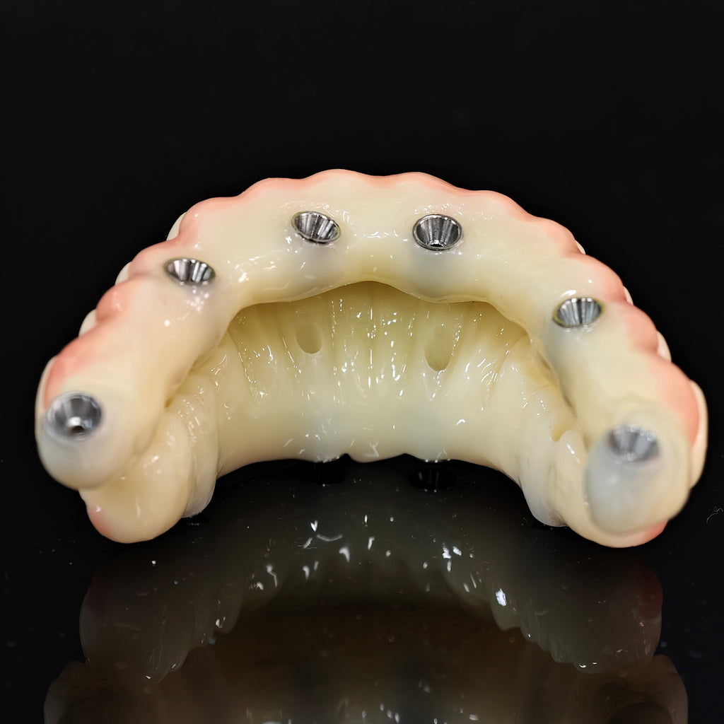 PMMA Bridge With Ti-Base Screw Retained Trying For Full Arch Restoration