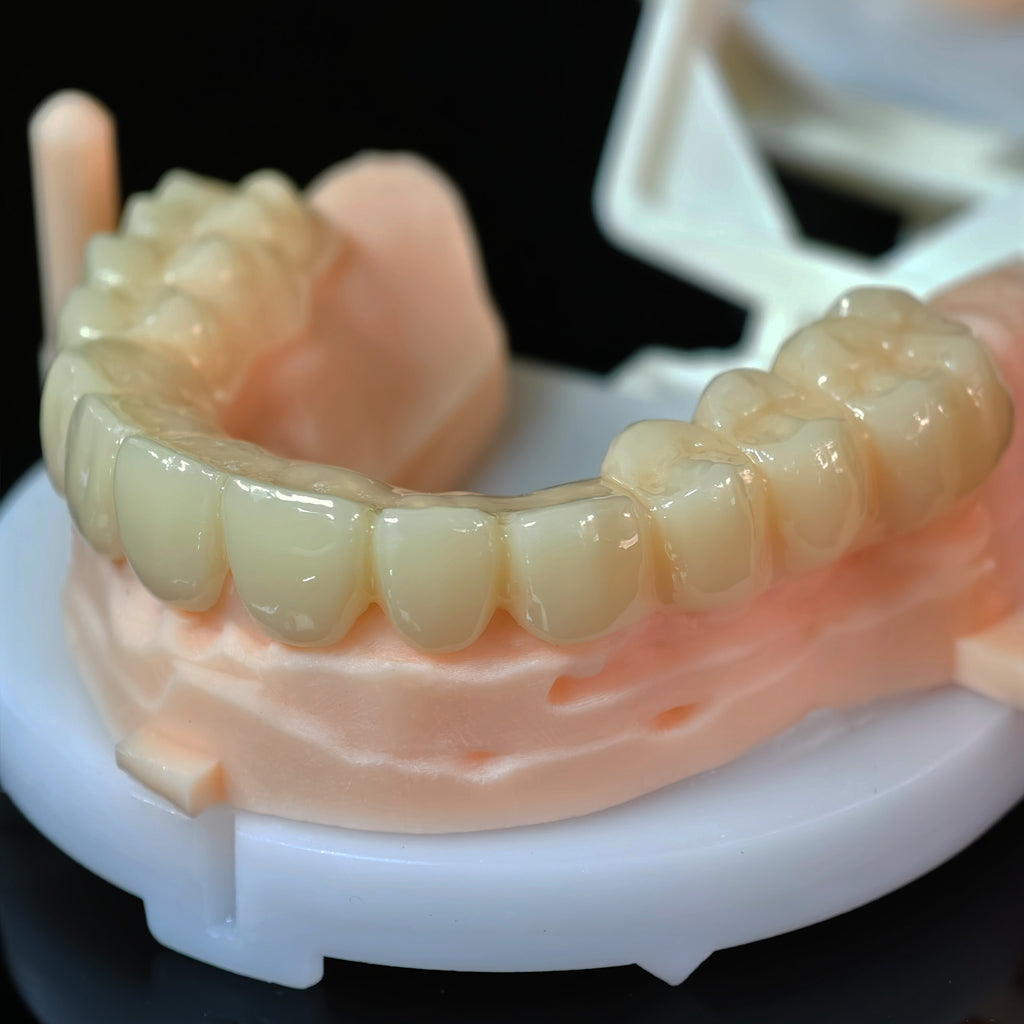 PMMA Bridge With Open Shell Preparing For Full Arch Dental Implants