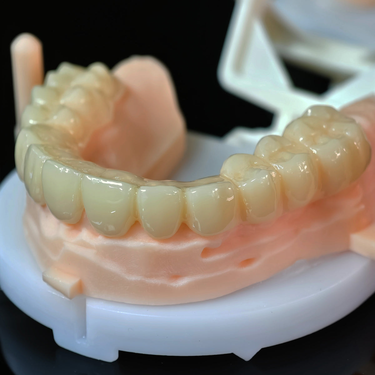 PMMA Bridge With Open Shell Preparing For Full Arch Dental Implants