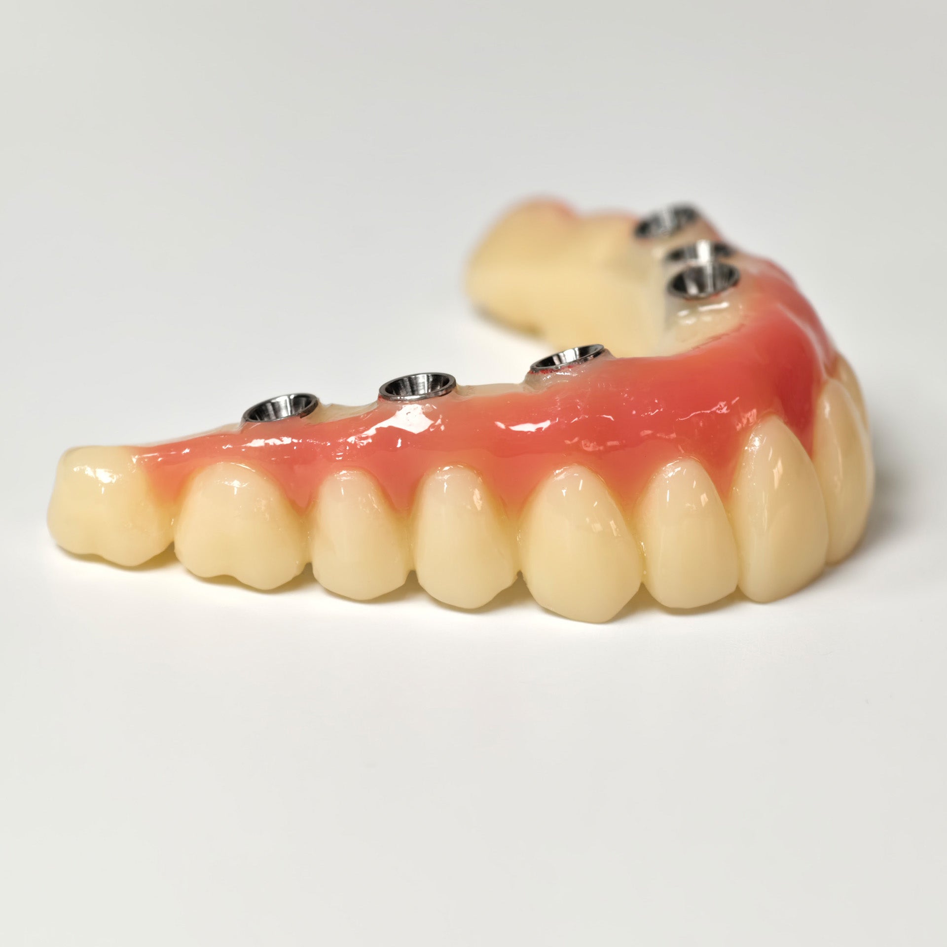 PMMA Bridge With Screw Retained