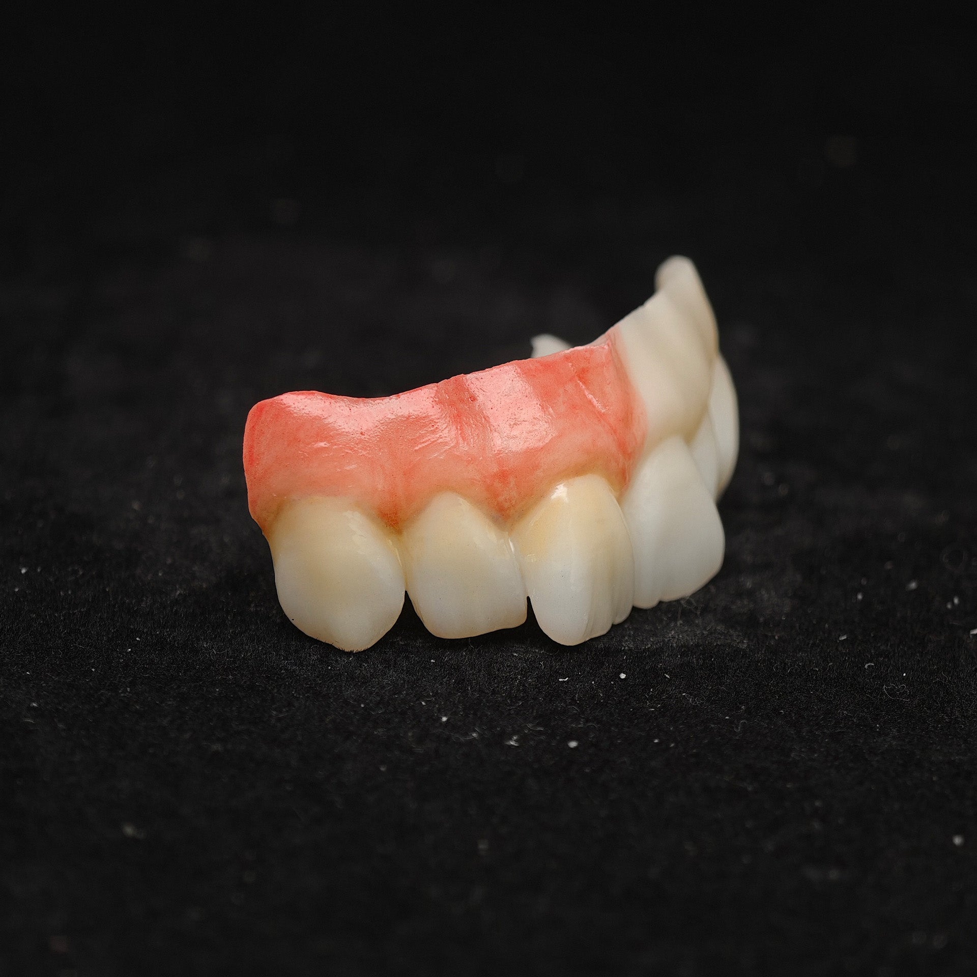 Ti-Bar Pure Titanium Metal Frame With Zirconia Bridge