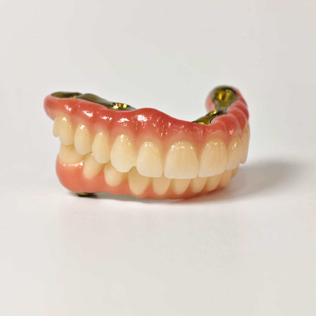 Ti-Bar Titanium Nitride Metal Frame With Zirconia Bridge For Full Arch Restoration
