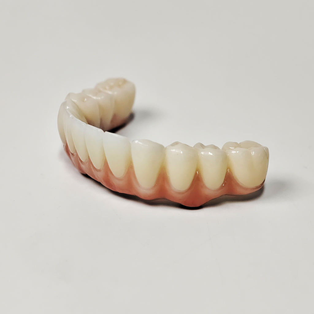 Ti-Bar Titanium Nitride Metal Frame With Zirconia Bridge For Full Arch Restoration