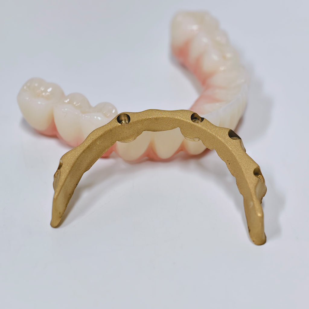 Ti-Bar Titanium Nitride Metal Frame With Zirconia Bridge For Full Arch Restoration