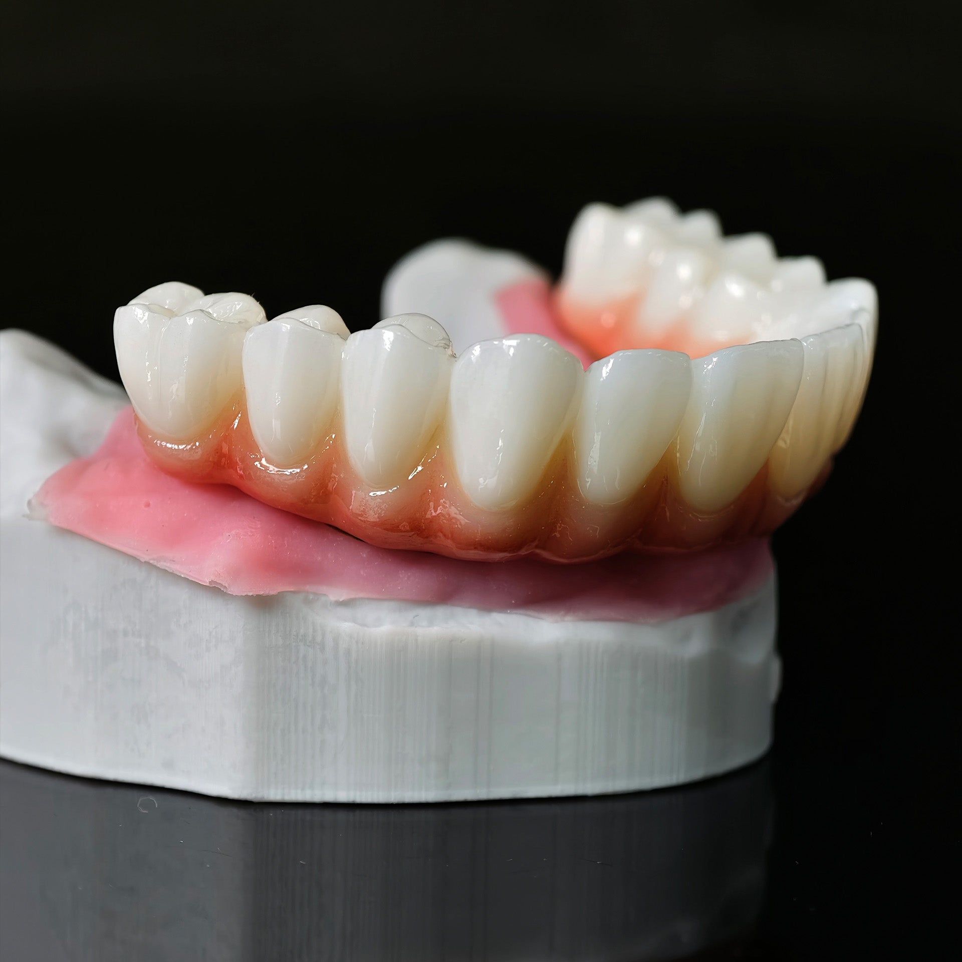 Ti-Bar Titanium Nitride Metal Frame With Zirconia Bridge For Full Arch Restoration