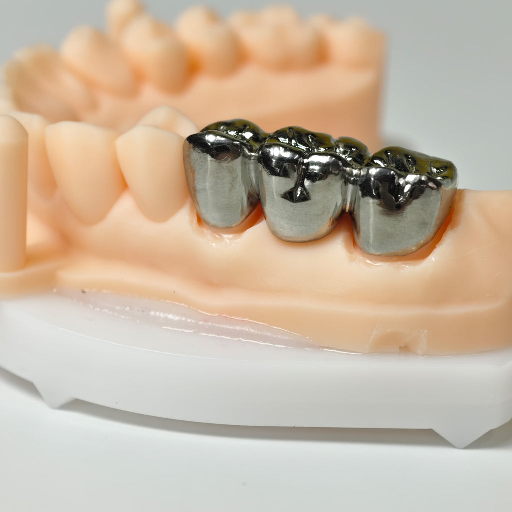 Titanium Crown With Cement Retained
