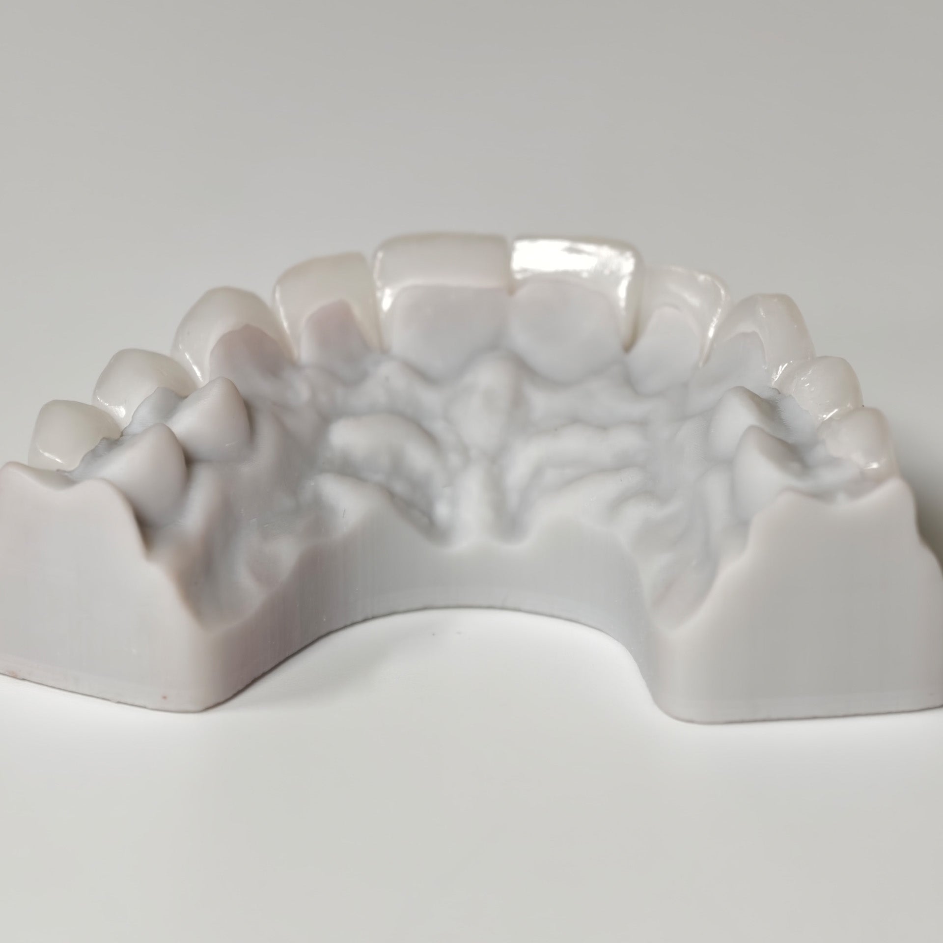 Ultra-Thin Emax Veneer. High Transparency/Translucent, Natural Shade