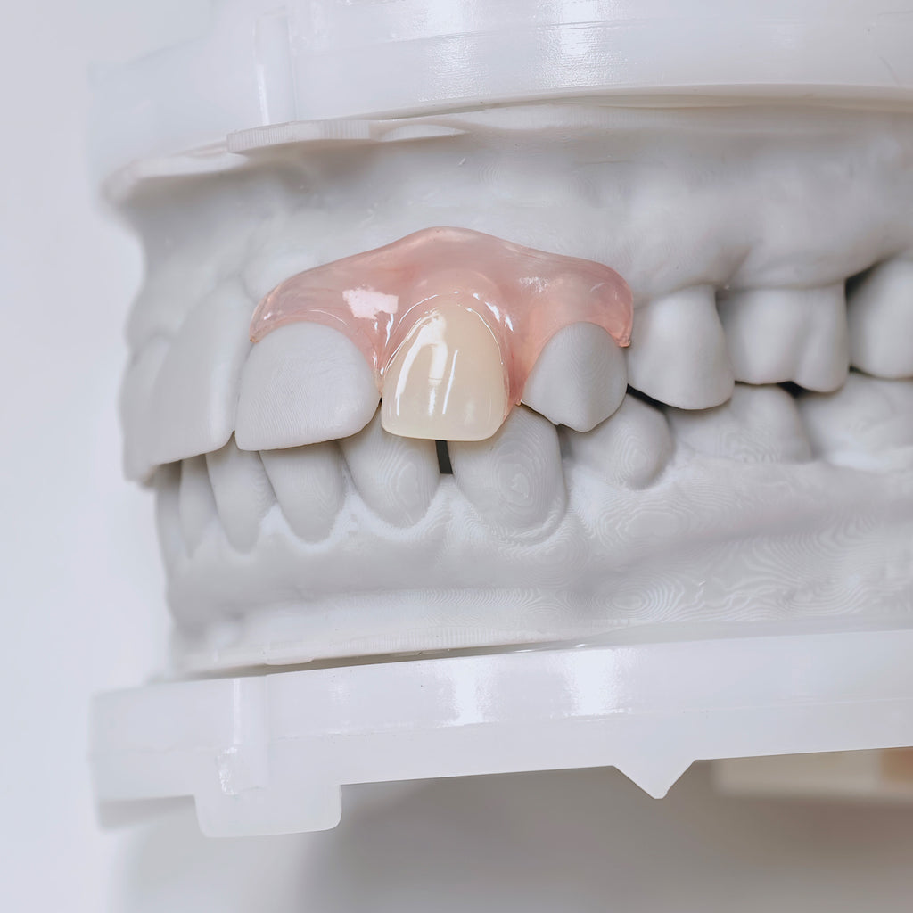 Valplast Denture Beautiful And Elastic Flexible Partial Natural Appearance