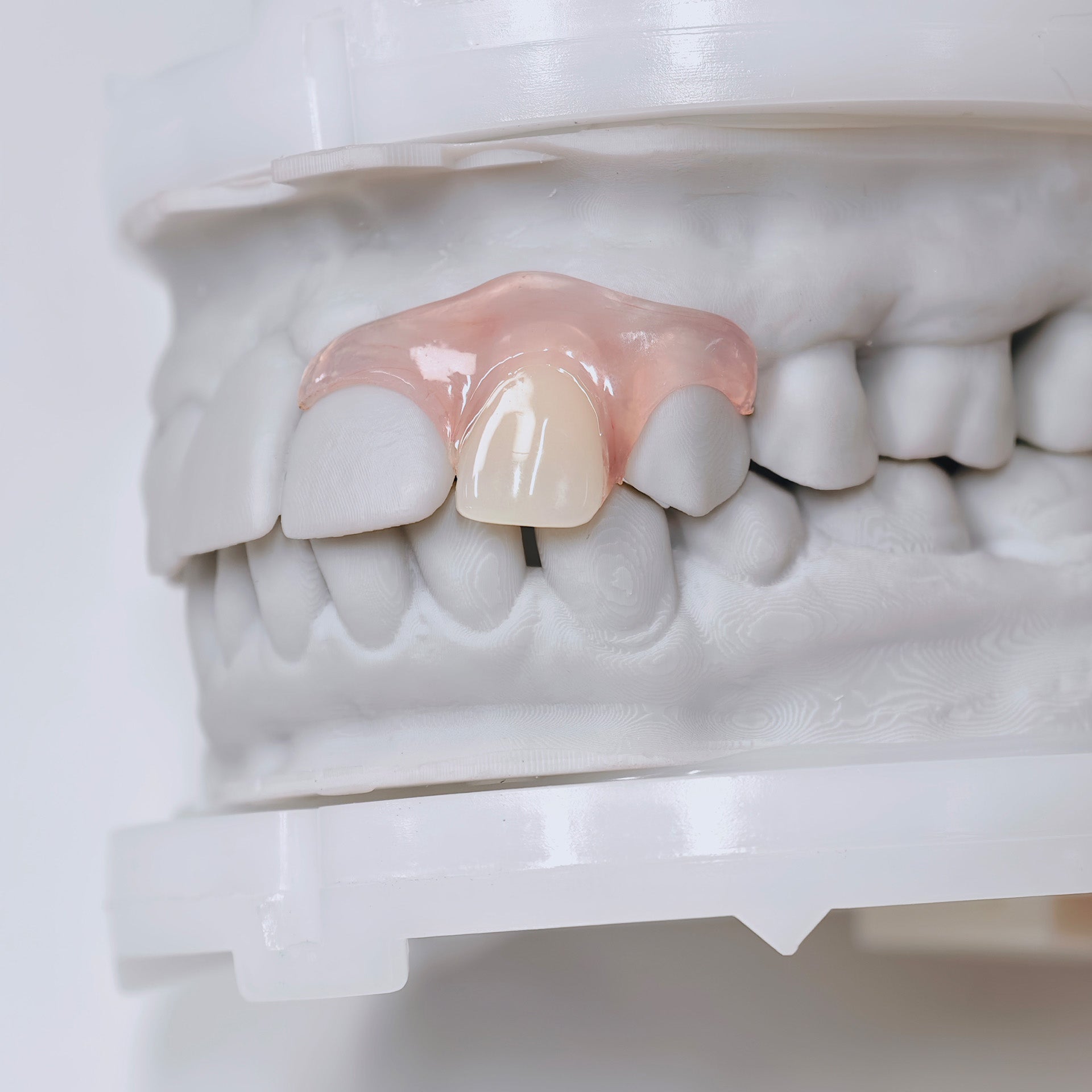 Valplast Denture Beautiful And Elastic Flexible Partial Natural Appearance