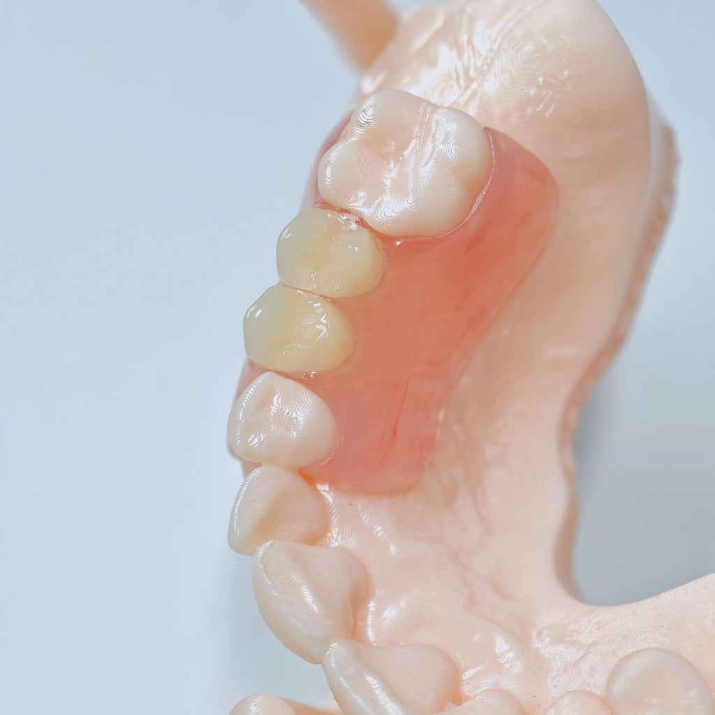 Valplast Denture Beautiful And Elastic Flexible Partial Natural Appearance