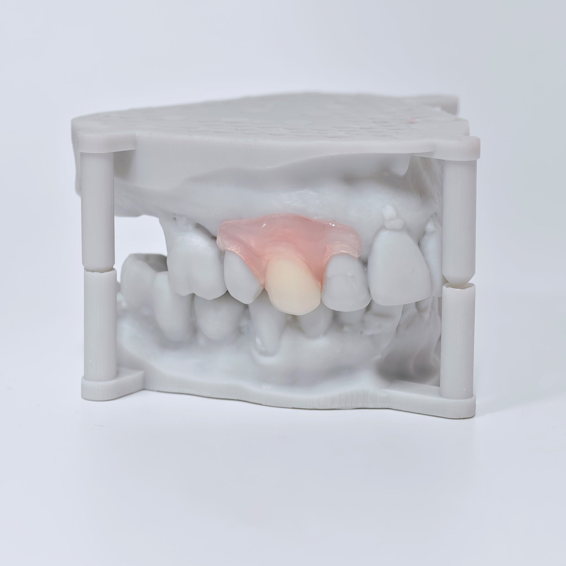 Valplast Denture Beautiful And Elastic Flexible Partial Natural Appearance