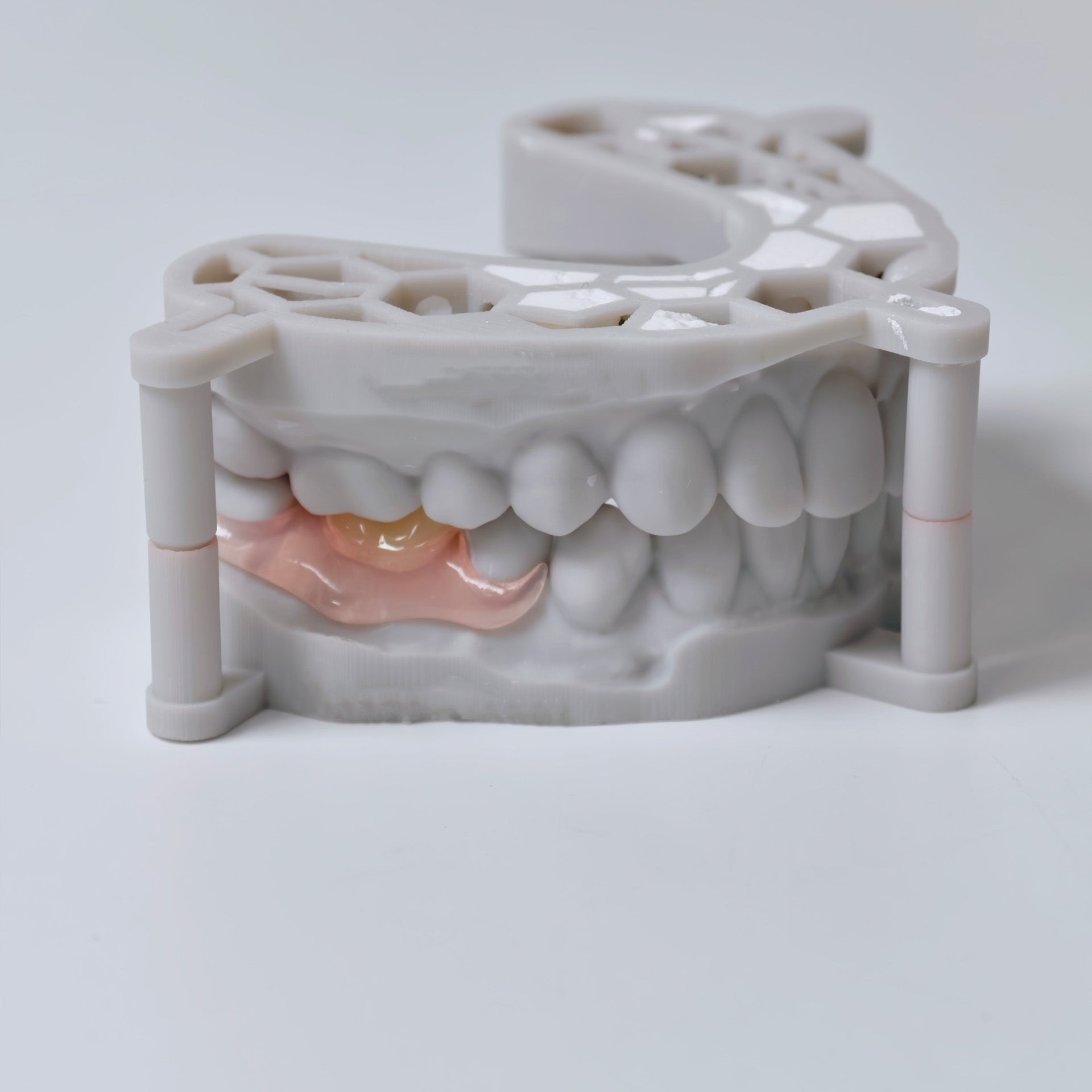 Valplast Denture Beautiful And Elastic Flexible Partial Natural Appearance