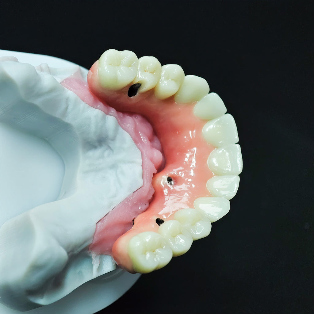 Zirconia-Enamel Hybrid Malo Bridge